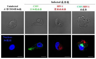CMV and HIV-1 co-infect the same CD34 stem cell.
